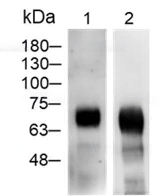 WB analysis of recombinant Human SARS-CoV-2 nucleocapsid protein.<br />Lane 1: Human anti-SARS-CoV & CoV-2 NP Antibody (IgG), 0.5 μg/mL (Leadgene cat. 17901)<br />Lane 2: Human anti-SARS-CoV & CoV-2 NP Antibody (IgM), 0.5 μg/mL (Leadgene cat. 18301)